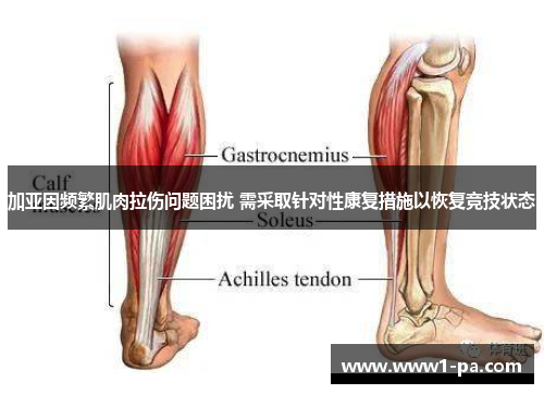 加亚因频繁肌肉拉伤问题困扰 需采取针对性康复措施以恢复竞技状态